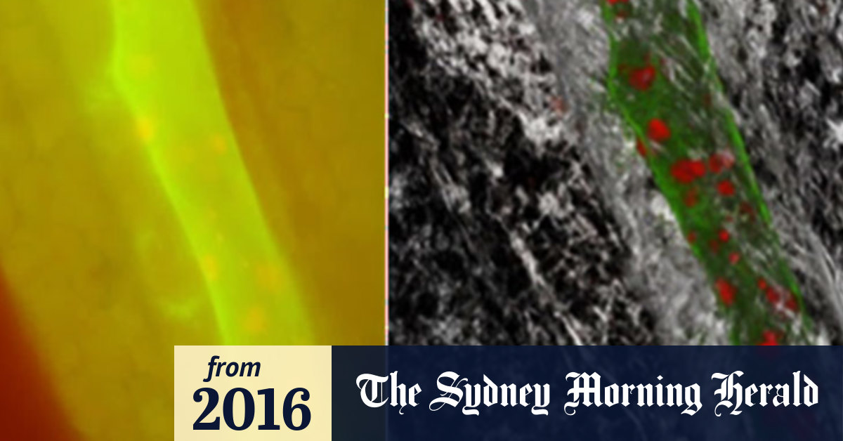 Video Chronic stress spreads cancer